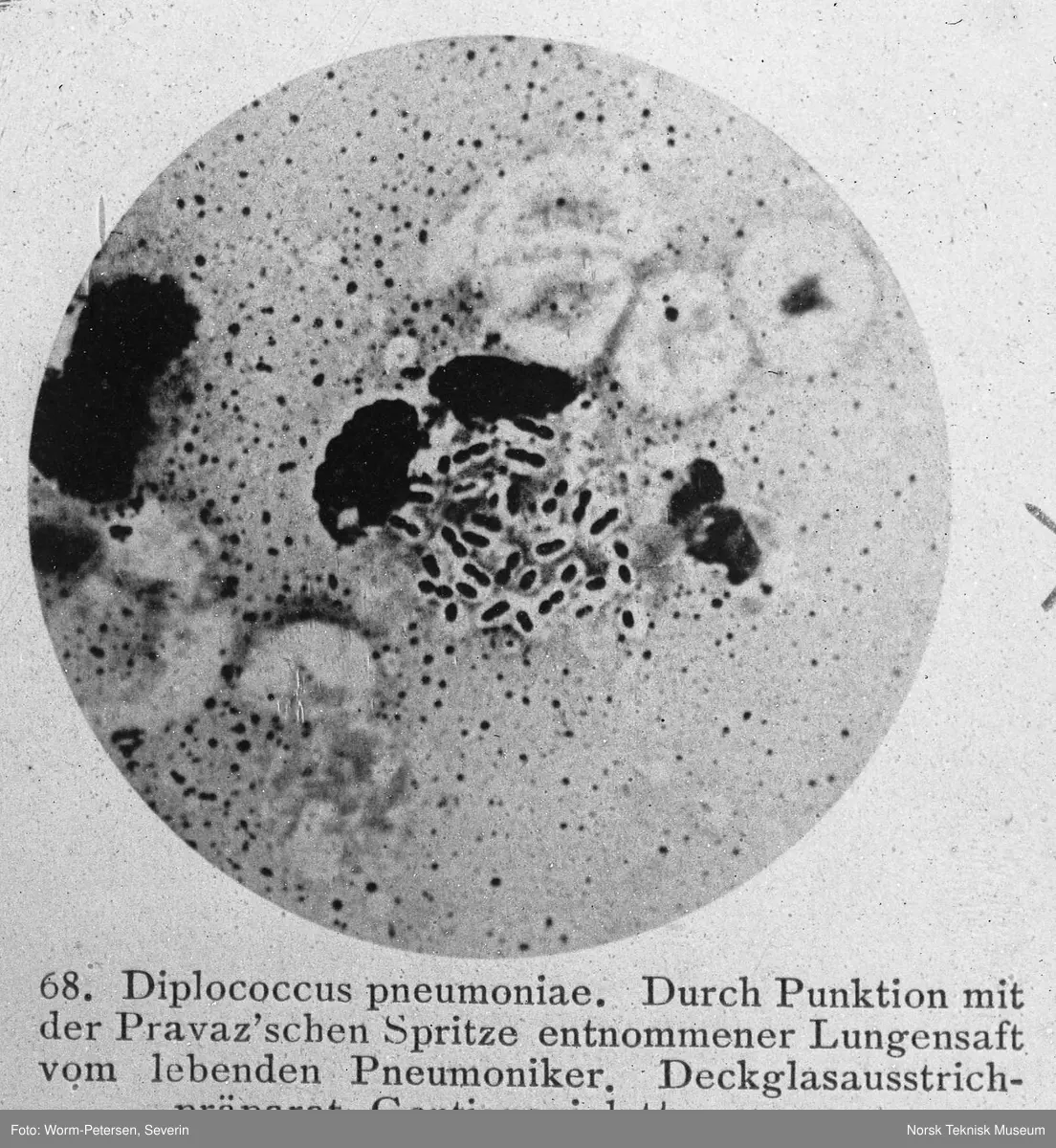 Mikroskopbilde, diplococcus pneumoniae, 1000:1.