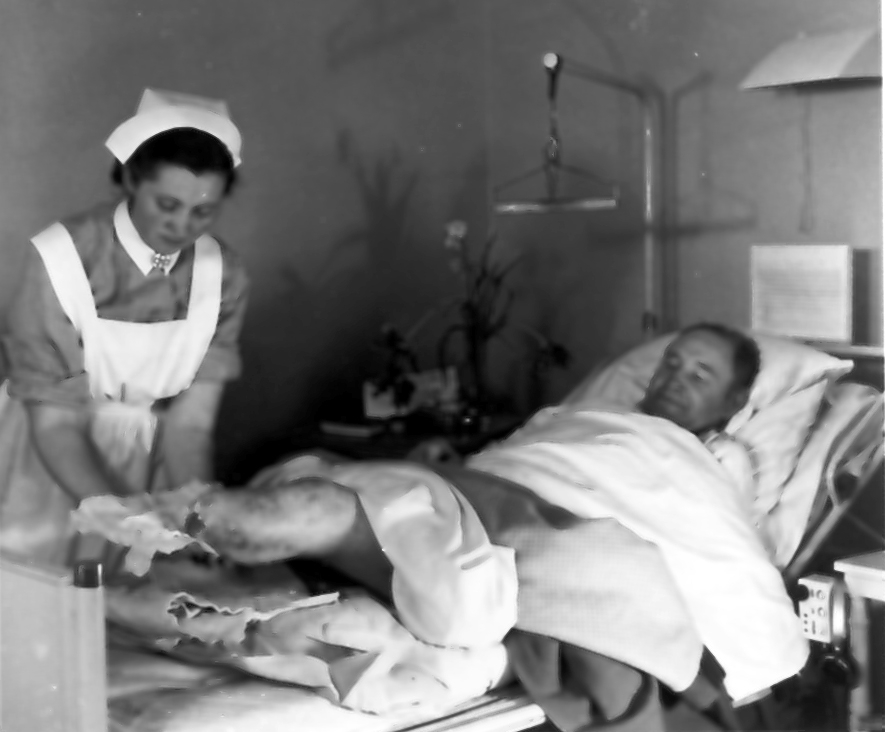 "Omläggning av amputerat ben".
(Benet förlorat vid sprängningsolycka). Från utställningen "Falköping i bild" 1952.