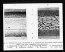 Skioptikonbild från Institutionen för fotografi vid Kungliga Tekniska Högskolan. Använd av professor Helmer Bäckström som föreläsningsmaterial. Bäckström var Sveriges första professor i fotografi vid Kungliga Tekniska Högskolan i Stockholm 1948-1958.
Mikrofotografi av sektioner av ett exponeras och framkallas dubbelsidig Agfa röntgenfilm (förstoringsgrad 100 diametrar).