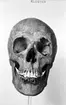 Gudhems kloster. Kranium av individ.