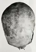 Grav 31. Skelett II. Kranium ovanifrån.