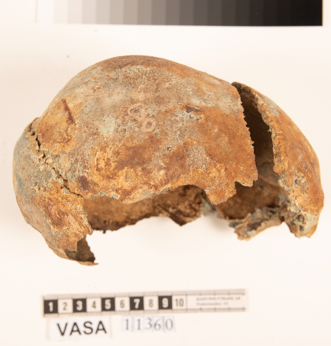 Del av skallben.
Cranium.