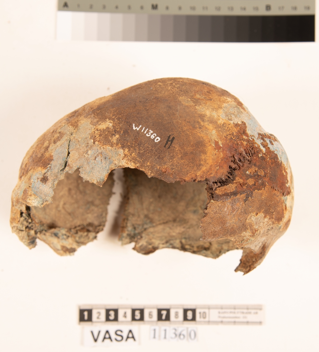 Del av skallben.
Cranium.