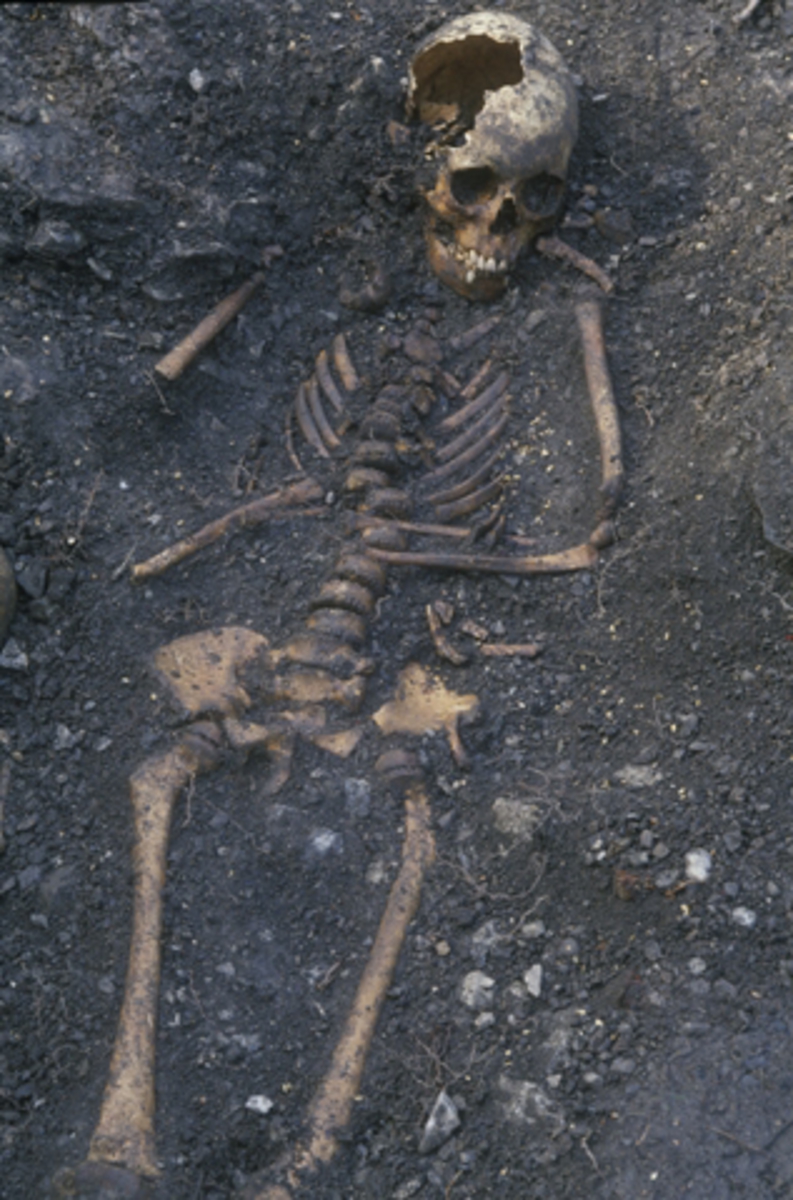 HKR200. ARKEOLOGI. SKJELETTER. 