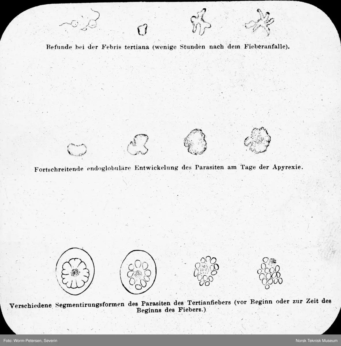 Malaria-plasmodier