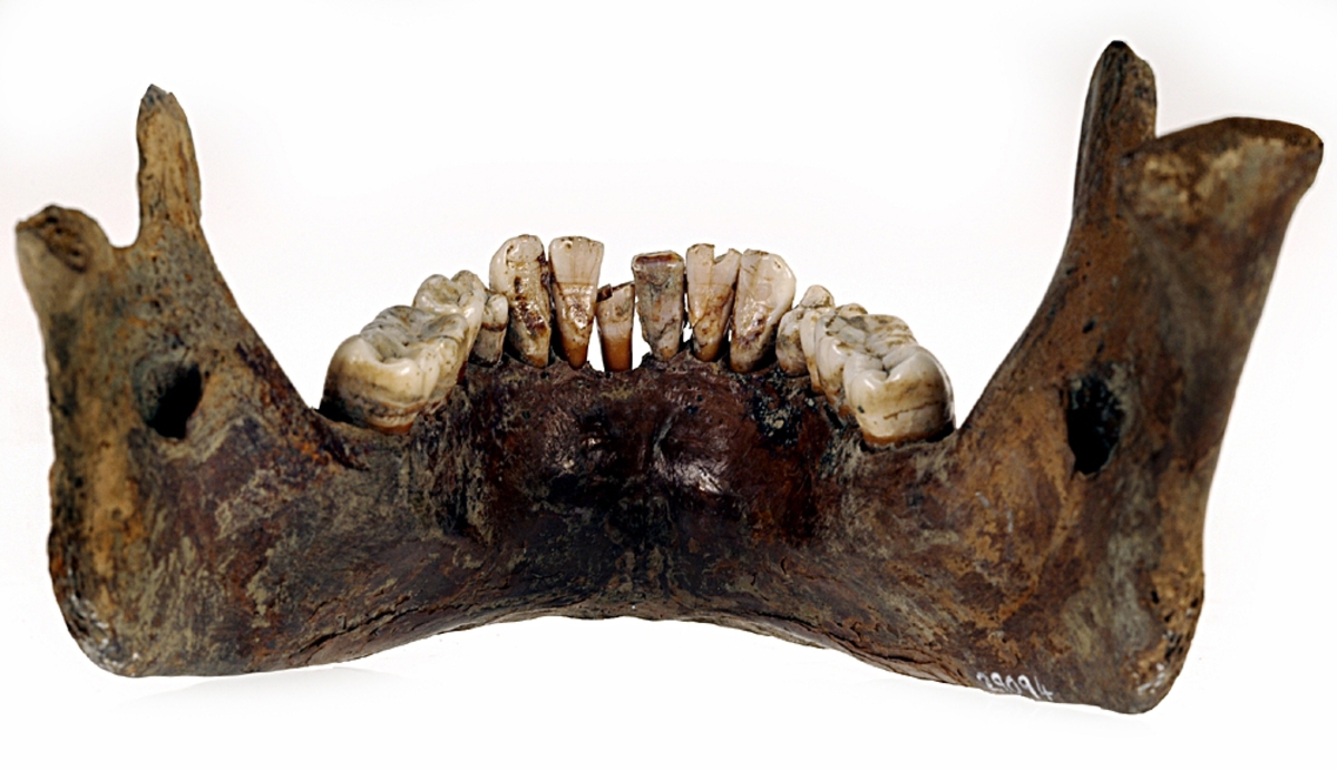 Underkäke med 14 tänder. I gott skick.
Mandibula.