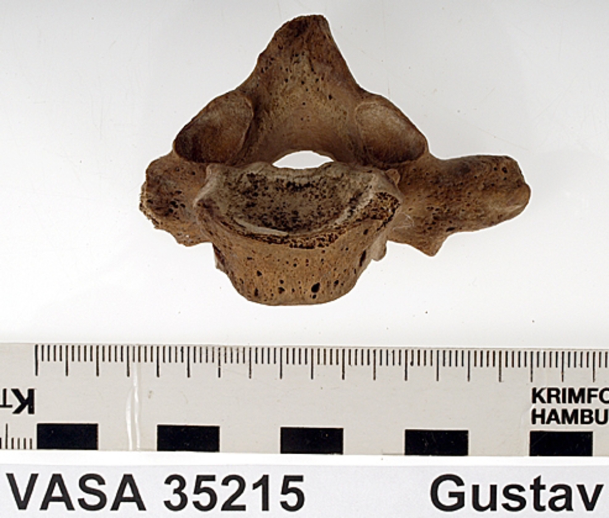 Bröstkota nr 1. I gott skick.
Vertebra Thoracicae no 1.