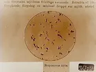 Streptococcus lactis.
Bilden tagen åt doktor Edward Broddeson, Oskarsparken 11, Örebro, för Konsums räkning.