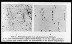 Skioptikonbild från Institutionen för fotografi vid Kungliga Tekniska Högskolan. Använd av professor Helmer Bäckström som föreläsningsmaterial. Bäckström var Sveriges första professor i fotografi vid Kungliga Tekniska Högskolan i Stockholm 1948-1958.
Mikrofoto av partiklar.
För mer info se: Agfa VI s.172