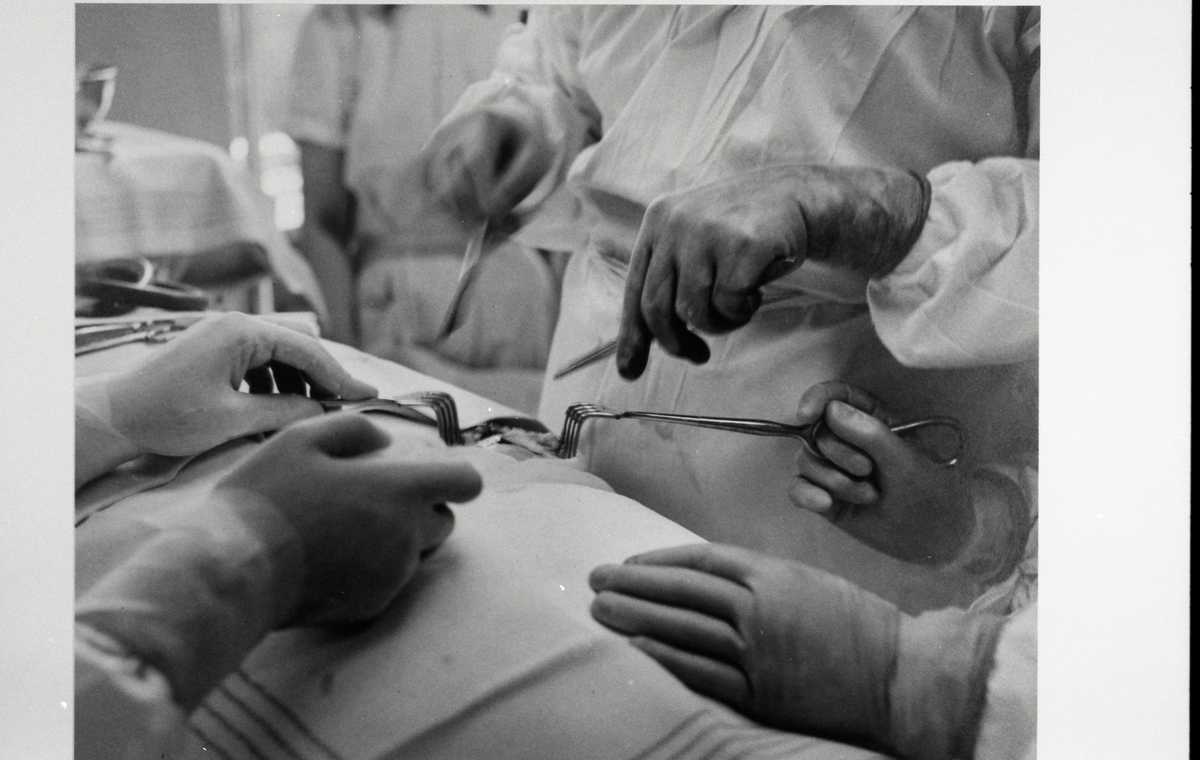"Gallstensoperation" (huden och den yttre muskulaturen har skurits igenom och bukhinnan skymtar i operationsfältet). Doktor Sam Pettersson. Från utställningen "Falköping i bild" 1952.