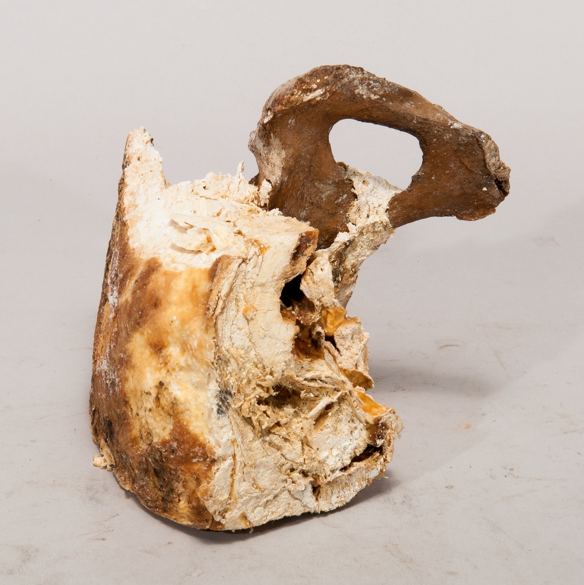 Prov på likvax, i låda av glas, med etikett med beskrivning: "Likvax eller adiopocer", "Profvet erhållet från den gammla kolerakyrkogården å Stadshagen, hvarifrån liken flyttades 1885 då gata den skulle framdragas. Jordmånen var vattensjuk lera och endast de lik som legat under grundvattnet vore förvarade, de övriga förmultnade. Pofvet är å kyrkogården minst 19 år, endast senaste begravningarna ägde rum vid epedemien år 1866. Skänkt af Ingenjör Sandén".  Måtten avser glaskuben.