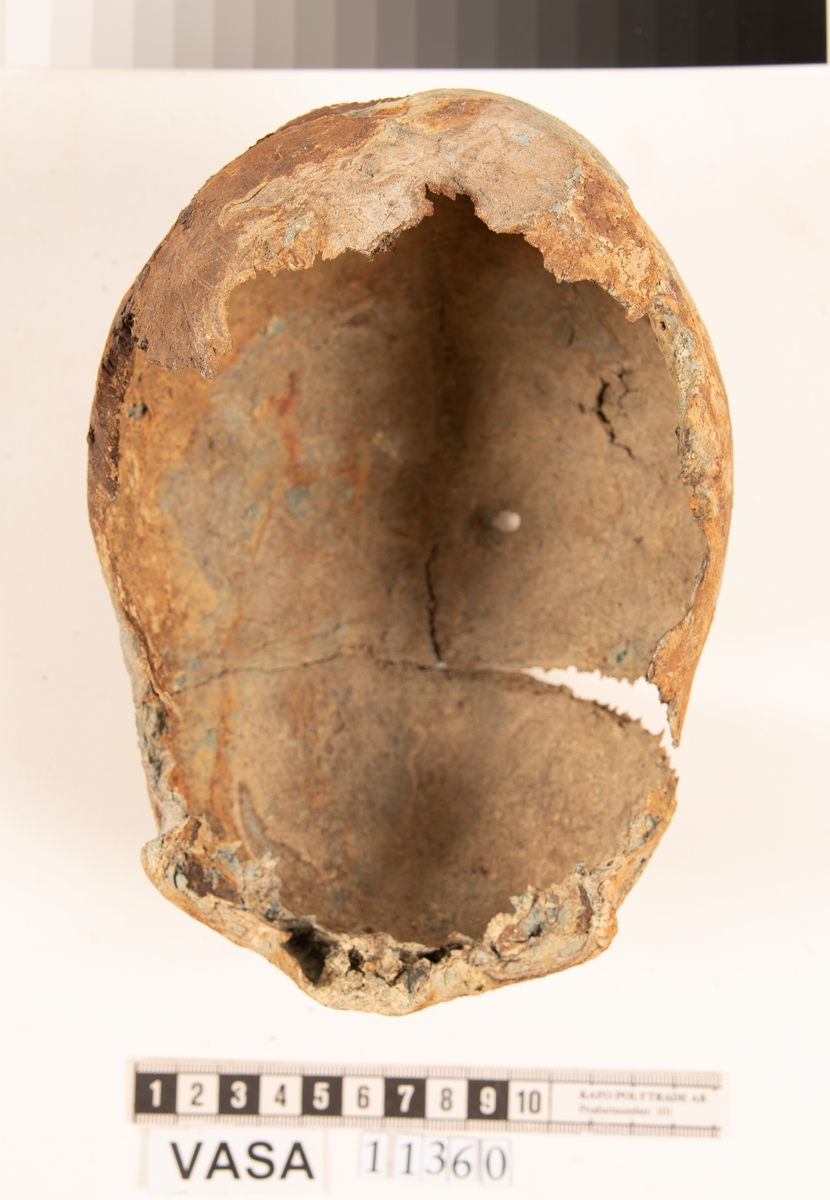 Del av skallben.
Cranium.