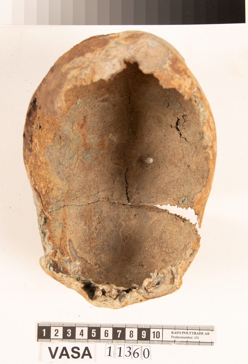 Del av skallben.
Cranium.