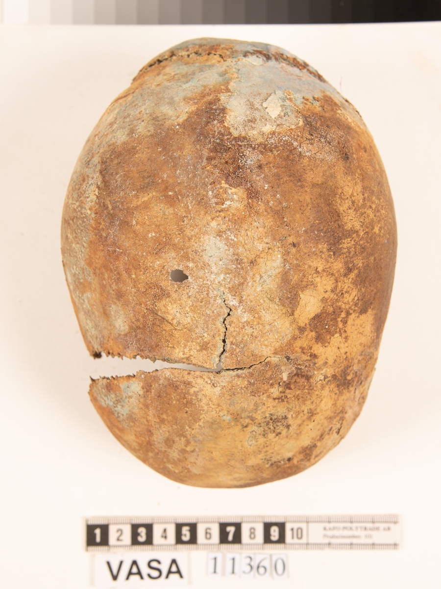 Del av skallben.
Cranium.