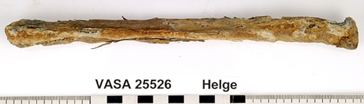 Strålben. höger. Flagigt och skört.
Radius, dexter.