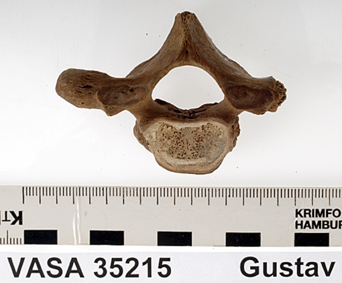 Bröstkota nr 1. I gott skick.
Vertebra Thoracicae no 1.