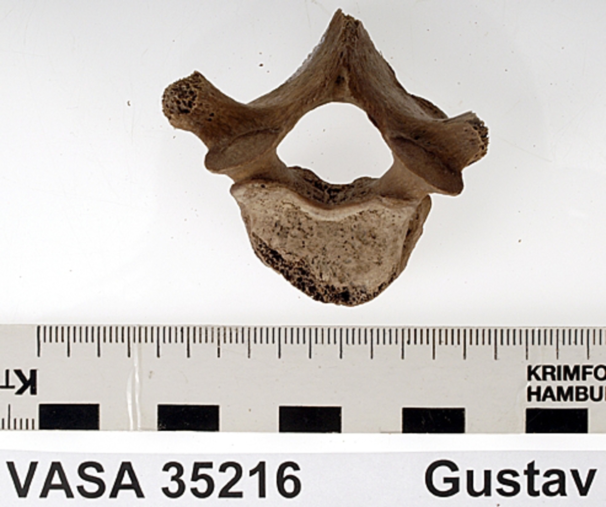 Bröstkota nr 2. I gott skick.
Vertebra Thoracicae no 2.