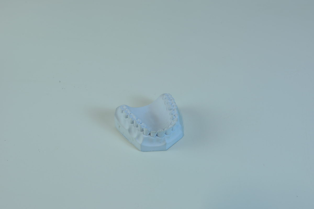 Liten pappeske med to tannsett i gips.